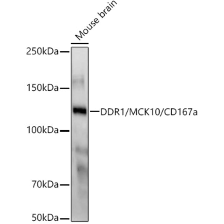 Western Blot - Anti-MCK10/NEP Antibody [ARC58637] (A309580) - Antibodies.com
