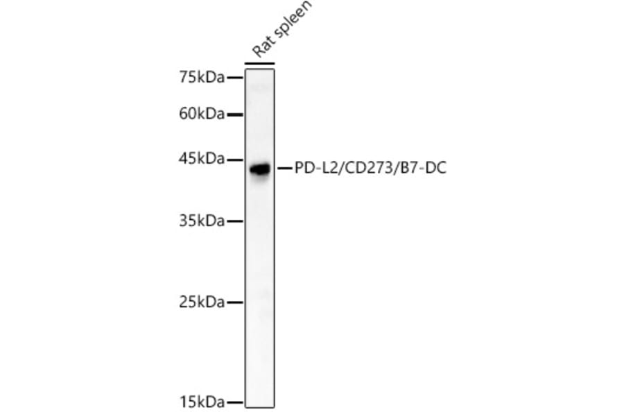 Western Blot - Anti-PD-L2 Antibody (A309581) - Antibodies.com