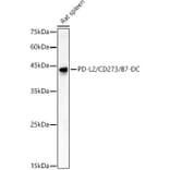 Western Blot - Anti-PD-L2 Antibody (A309581) - Antibodies.com