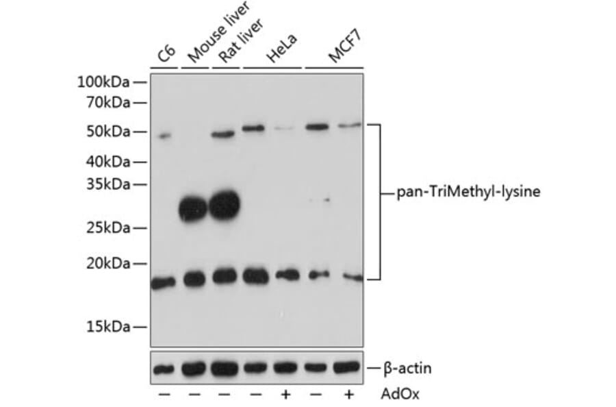 Western Blot - Anti-pan-tri-methyl Lysine Antibody (A309588) - Antibodies.com