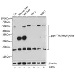 Western Blot - Anti-pan-tri-methyl Lysine Antibody (A309588) - Antibodies.com