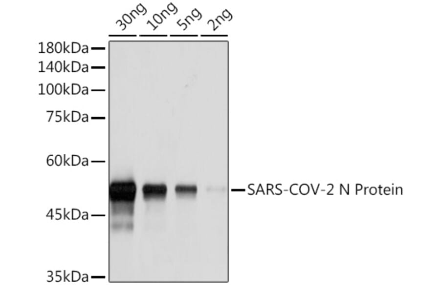 Western Blot - Anti-SARS-CoV2 Nucleoprotein Antibody [ARC5077-02] (A309590) - Antibodies.com