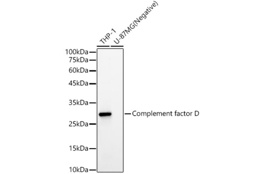 Western Blot - Anti-Factor D/CFD Antibody [ARC59438] (A309594) - Antibodies.com