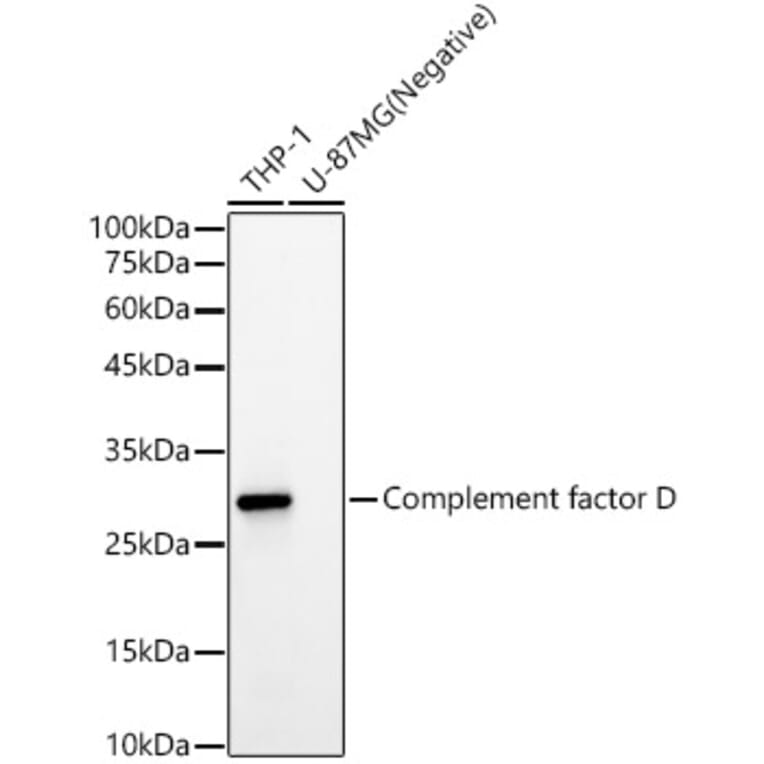 Western Blot - Anti-Factor D/CFD Antibody [ARC59438] (A309594) - Antibodies.com