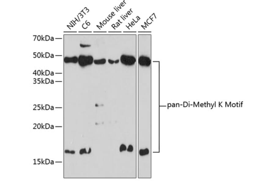 Western Blot - Anti-pan di-methyl Lysine Antibody (A309597) - Antibodies.com