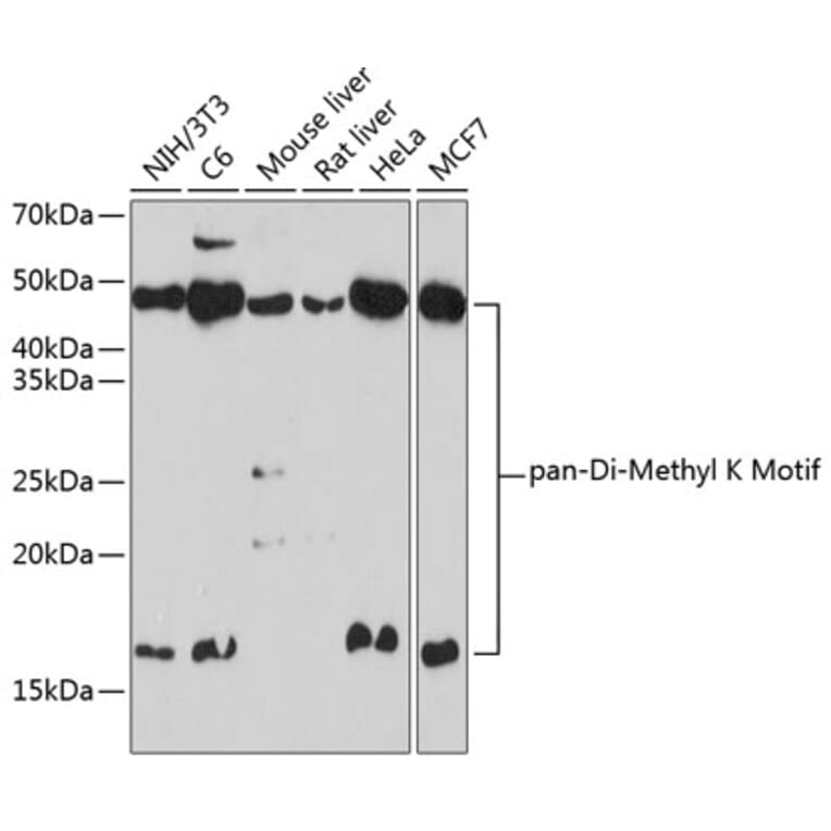 Western Blot - Anti-pan di-methyl Lysine Antibody (A309597) - Antibodies.com