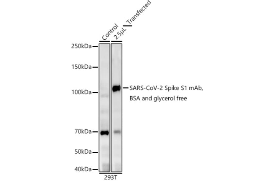Western Blot - Anti-SARS-CoV2 Spike Glycoprotein S1 Antibody [ARC2373] (A309598) - Antibodies.com