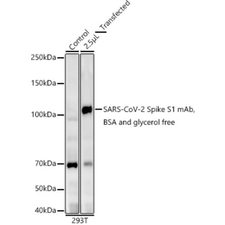 Western Blot - Anti-SARS-CoV2 Spike Glycoprotein S1 Antibody [ARC2373] (A309598) - Antibodies.com