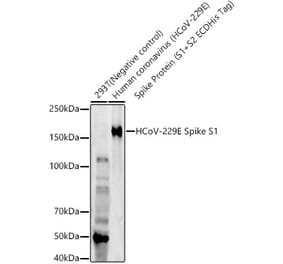 Western Blot - Anti-Human Coronavirus Spike glycoprotein Antibody [ARC57845] (A309599) - Antibodies.com