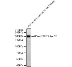 Western Blot - Anti-Human Coronavirus Spike glycoprotein Antibody [ARC57280] (A309600) - Antibodies.com