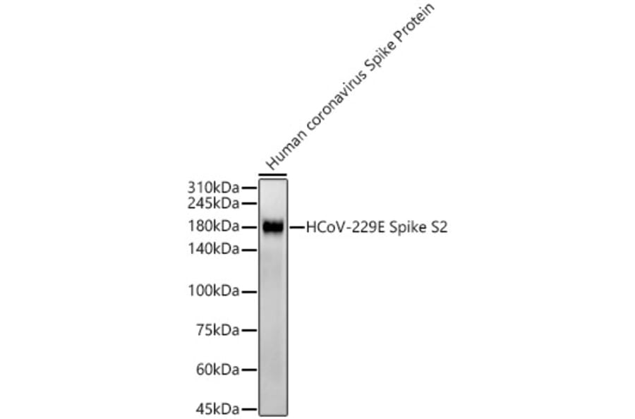 Western Blot - Anti-Human Coronavirus Spike glycoprotein Antibody [ARC57280] (A309600) - Antibodies.com