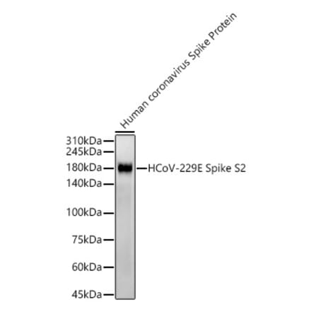 Western Blot - Anti-Human Coronavirus Spike glycoprotein Antibody [ARC57280] (A309600) - Antibodies.com