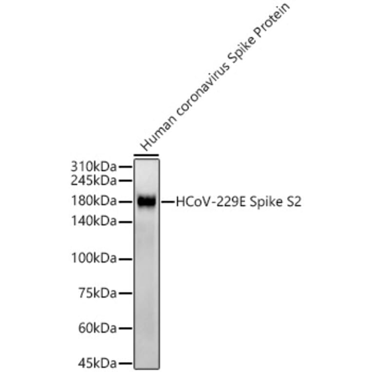 Western Blot - Anti-Human Coronavirus Spike glycoprotein Antibody [ARC57280] (A309600) - Antibodies.com