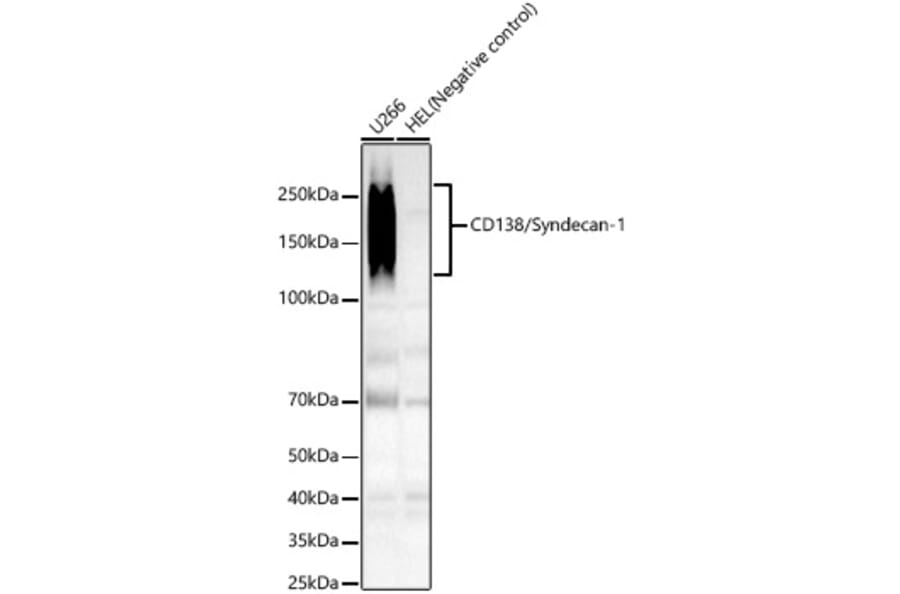 Western Blot - Anti-Syndecan-1 Antibody [ARC60160] (A309602) - Antibodies.com