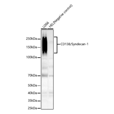 Western Blot - Anti-Syndecan-1 Antibody [ARC60160] (A309602) - Antibodies.com
