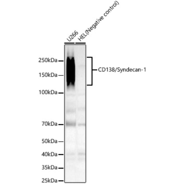 Western Blot - Anti-Syndecan-1 Antibody [ARC60160] (A309602) - Antibodies.com