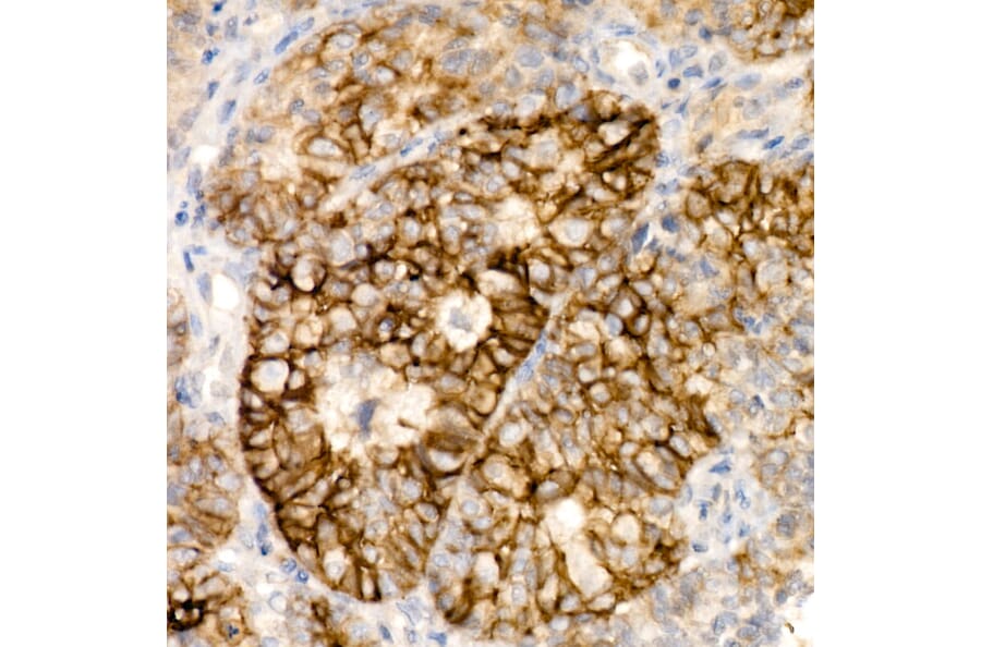 Immunohistochemistry - Anti-Syndecan-1 Antibody [ARC60158] (A309603) - Antibodies.com
