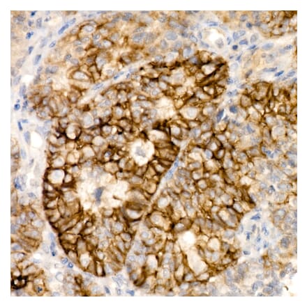 Immunohistochemistry - Anti-Syndecan-1 Antibody [ARC60158] (A309603) - Antibodies.com