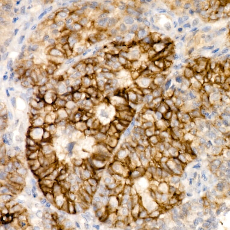 Immunohistochemistry - Anti-Syndecan-1 Antibody [ARC60158] (A309603) - Antibodies.com