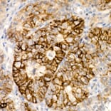 Immunohistochemistry - Anti-Syndecan-1 Antibody [ARC60158] (A309603) - Antibodies.com