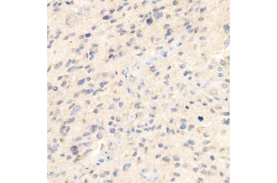 Immunohistochemistry - Anti-Syndecan-1 Antibody [ARC60158] (A309603) - Antibodies.com