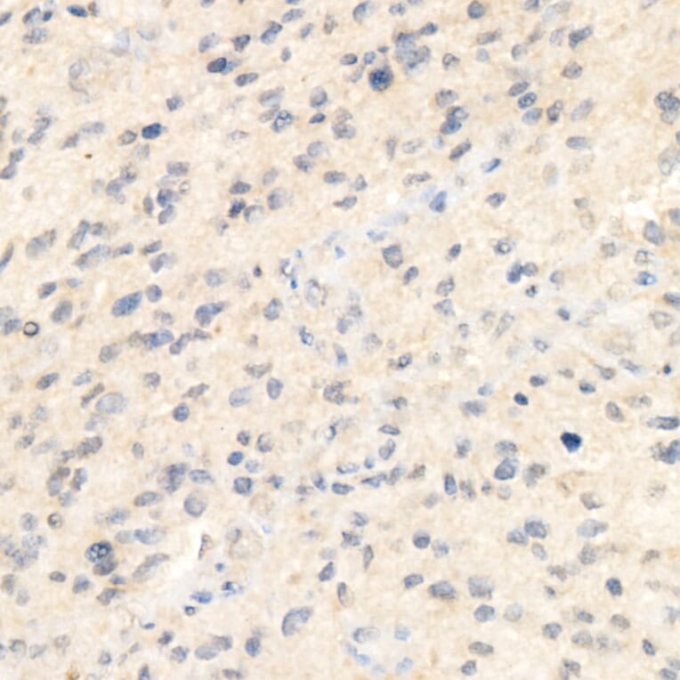Immunohistochemistry - Anti-Syndecan-1 Antibody [ARC60158] (A309603) - Antibodies.com
