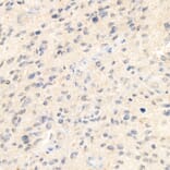 Immunohistochemistry - Anti-Syndecan-1 Antibody [ARC60158] (A309603) - Antibodies.com