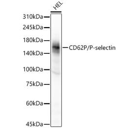 Western Blot - Anti-P-Selectin Antibody [ARC57437] (A309604) - Antibodies.com