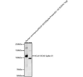 Western Blot - Anti-Human Coronavirus Spike glycoprotein Antibody [ARC57814] (A309607) - Antibodies.com