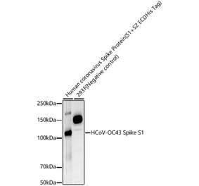 Western Blot - Anti-Human Coronavirus Spike glycoprotein Antibody [ARC57815] (A309608) - Antibodies.com