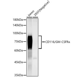 Western Blot - Anti-CD116 Antibody [ARC59284] (A309615) - Antibodies.com