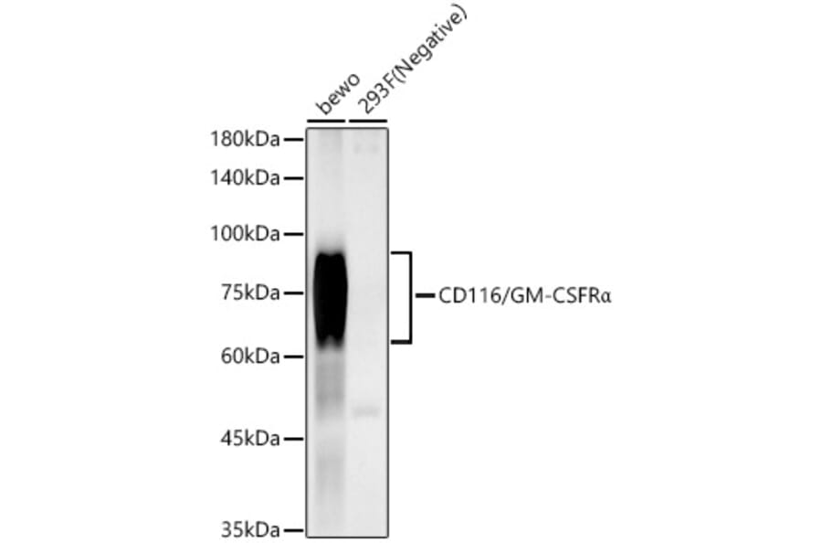 Western Blot - Anti-CD116 Antibody [ARC59284] (A309615) - Antibodies.com