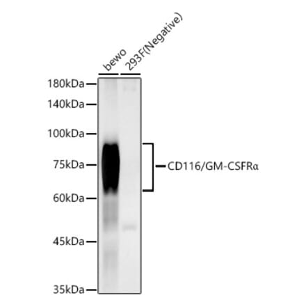 Western Blot - Anti-CD116 Antibody [ARC59284] (A309615) - Antibodies.com