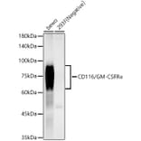 Western Blot - Anti-CD116 Antibody [ARC59284] (A309615) - Antibodies.com