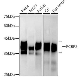 Western Blot - Anti-PCBP2/hnRNP E2 Antibody [ARC2994] (A309620) - Antibodies.com