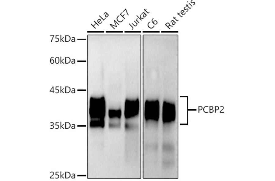 Western Blot - Anti-PCBP2/hnRNP E2 Antibody [ARC2994] (A309620) - Antibodies.com