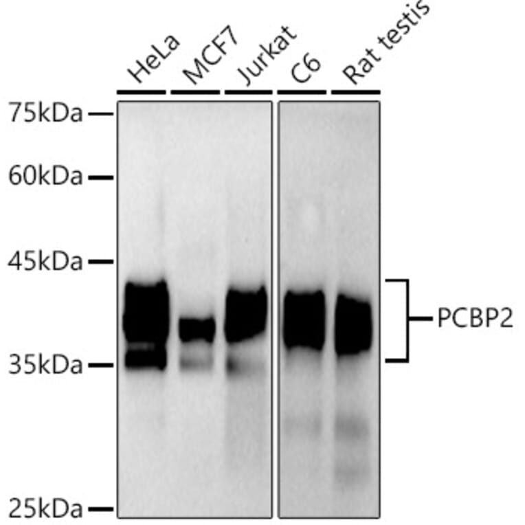 Western Blot - Anti-PCBP2/hnRNP E2 Antibody [ARC2994] (A309620) - Antibodies.com