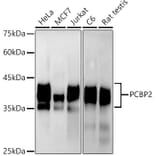 Western Blot - Anti-PCBP2/hnRNP E2 Antibody [ARC2994] (A309620) - Antibodies.com