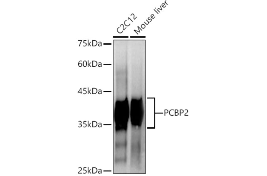 Western Blot - Anti-PCBP2/hnRNP E2 Antibody [ARC2994] (A309620) - Antibodies.com