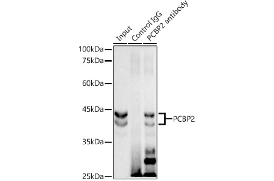 Western Blot - Anti-PCBP2/hnRNP E2 Antibody [ARC2994] (A309620) - Antibodies.com