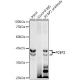Western Blot - Anti-PCBP2/hnRNP E2 Antibody [ARC2994] (A309620) - Antibodies.com