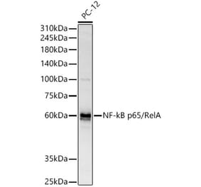 Western Blot - Anti-NF-kB p65 Antibody (A309621) - Antibodies.com