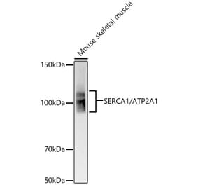 Western Blot - Anti-SERCA1 ATPase Antibody [ARC58464] (A309624) - Antibodies.com