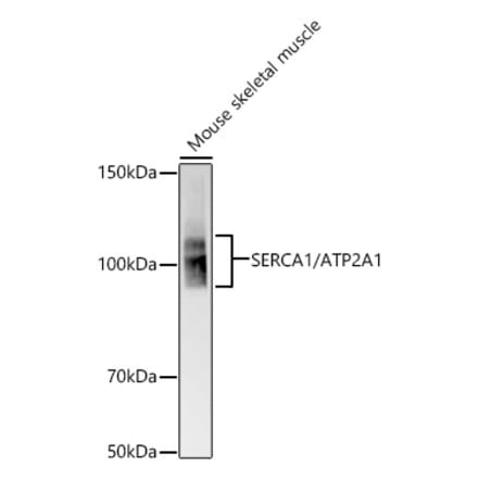 Western Blot - Anti-SERCA1 ATPase Antibody [ARC58464] (A309624) - Antibodies.com
