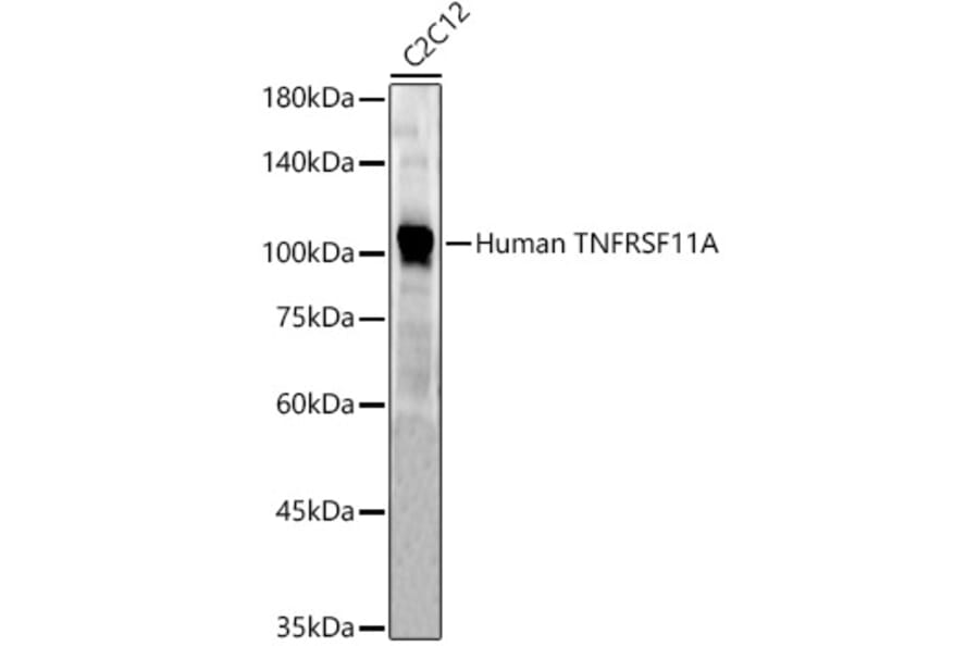 Western Blot - Anti-RANK Antibody (A309626) - Antibodies.com