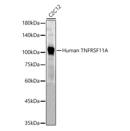 Western Blot - Anti-RANK Antibody (A309626) - Antibodies.com