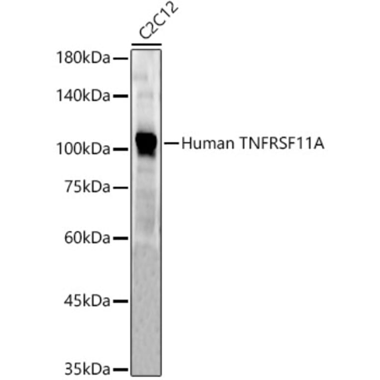 Western Blot - Anti-RANK Antibody (A309626) - Antibodies.com