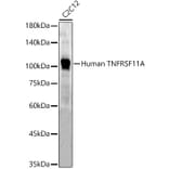 Western Blot - Anti-RANK Antibody (A309626) - Antibodies.com