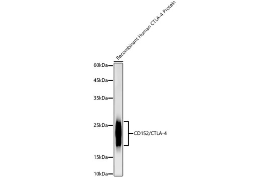 Western Blot - Anti-CTLA4 Antibody (A309628) - Antibodies.com