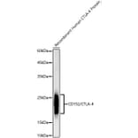Western Blot - Anti-CTLA4 Antibody (A309628) - Antibodies.com